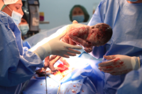 ზაზა სინაურიძემ მშობიარე გოგონა პლაცენტა პერკრეტას სასიკვდილო დიაგნოზისგან იხსნა - "მსგავსი ოპერაცია მსოფლიო მედიცინაში აღწერილი არ არის"