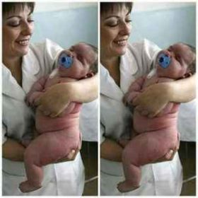 საქართველოში დაიბადა ბავშვი, რომელიც 7.5 კგ-ს იწონის