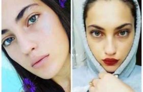 სალომე ვიბლიანი: "მოდელობა მინდოდა, მაგრამ..." - 19 წლის ულამაზესი გოგონა მძიმე დიაგნოზთან პირისპირ