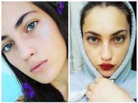 სალომე ვიბლიანი: "მოდელობა მინდოდა, მაგრამ..." - 19 წლის ულამაზესი გოგონა მძიმე დიაგნოზთან პირისპირ