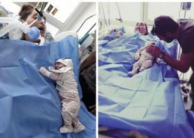 26 წლის ნათია ჩაგანავა, რომელიც საკეისროს შემდეგ კომაში იყო, გარდაიცვალა