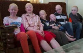 ბავშვები, რომელთა სხეულიც ოქროს ფასად ფასობს