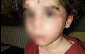 ,,ნა­ცე­მიც აღარ ერ­ქვა, ეს იყო წა­მე­ბა! ბავ­შვი გა­ოგ­ნე­ბუ­ლი, მო­ბუ­ზუ­ლი იჯდა, აღა­რა­ფე­რი რომ არ ადარ­დებს, ისე გა­მო­ი­ყუ­რე­ბო­და"