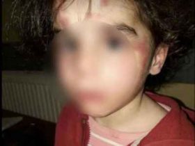 ,,ნა­ცე­მიც აღარ ერ­ქვა, ეს იყო წა­მე­ბა! ბავ­შვი გა­ოგ­ნე­ბუ­ლი, მო­ბუ­ზუ­ლი იჯდა, აღა­რა­ფე­რი რომ არ ადარ­დებს, ისე გა­მო­ი­ყუ­რე­ბო­და"