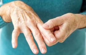 ამერიკელმა მეცნიერებმა ართრიტის მკურნალობის მეთოდს მიაგნეს