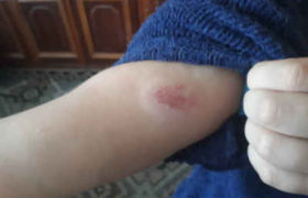 ,,ჩემი შვილი დაკბენილია, დირექტორმა მითხრა, თუ გინდა, ბავშვი საერთოდ გაიყვანე სკოლიდანო"