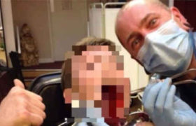 ტატუს ოსტატი კლიენტებს ძუძუს თავებს აჭრიდა