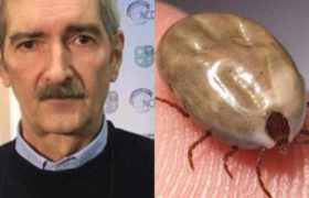 ზაფხულის საშიში დაავადება - ,,ტანი კარგად დაათვალიერეთ, თუ სადმე ტკიპაა, ძალიან ფრთხილად მოიცილეთ" ზაფხულის საშიში დაავადება - ,,ტანი კარგად დაათვალიერეთ, თუ სადმე ტკიპაა, ძალიან ფრთხილად მოიცილეთ"