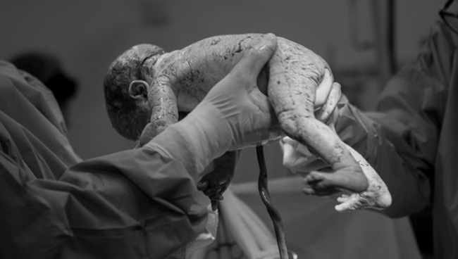 ,,ბავშვმა სუნთქვა რომ დაიწყო, ექიმს ცრემლები წამოუვიდა" - ფოტოგრაფი ნინო ინაძე მშობიარობებს იღებს