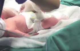 ,,პოლიციელმა ჩაიხუტა და თავისი სხეულის ტემპერატურით უნარჩუნებდა სიცოცხლეს" - გურიაში თხილის ბაღში ჩვილი იპოვეს