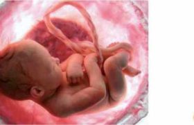 ჭიპლარის სისხლის ღეროვანი უჯრედები გადაარჩენს სიცოცხლეს ჭიპლარის სისხლის ღეროვანი უჯრედები გადაარჩენს სიცოცხლეს