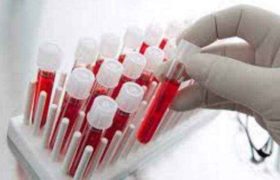 როგორ გაიხსნა დები ლომიძეების მკვლელობის საქმე - სატყუარა დამნაშავისთვის