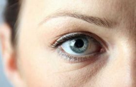 მოციმციმე თვალების საიდუმლო - ნაადრევმა ნაოჭებმა რომ არ შეგაწუხოთ