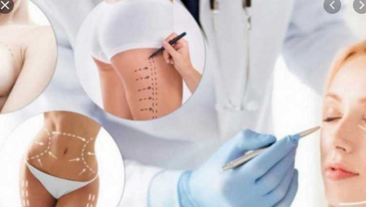 "ძმის ცოლს ვურჩიე, პლასტიკურ ქირურგებთან არ ევლო და ხმას აღარ მცემს"