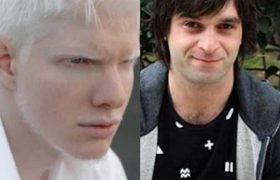 ამიკო ჩოხარაძე: ,,როცა მიჭირდა, ბერა დამიდგა გვერდით... ის ბინა ბანკის ვალების გამო გავყიდე" ამიკო ჩოხარაძე: ,,როცა მიჭირდა, ბერა დამიდგა გვერდით... ის ბინა ბანკის ვალების გამო გავყიდე"