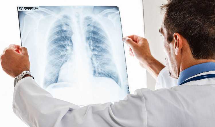 იმუნოთერაპია - წარმატებული იარაღი ფილტვის კიბოსთან ბრძოლაში