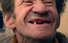 რუსეთში სტომატოლოგიური მასალების მწარმოებლებმა იმპორტი შეაჩერეს