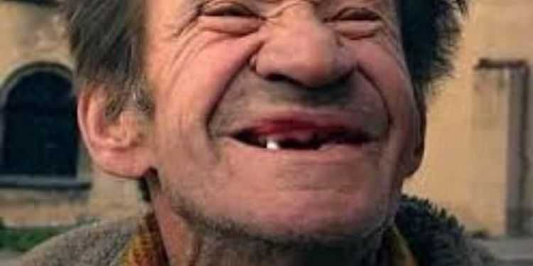 რუსეთში სტომატოლოგიური მასალების მწარმოებლებმა იმპორტი შეაჩერეს